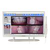 YF-2200P USB Dental Camera