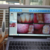 MD360 USB 1080P Wire HD Intraoral Camera 