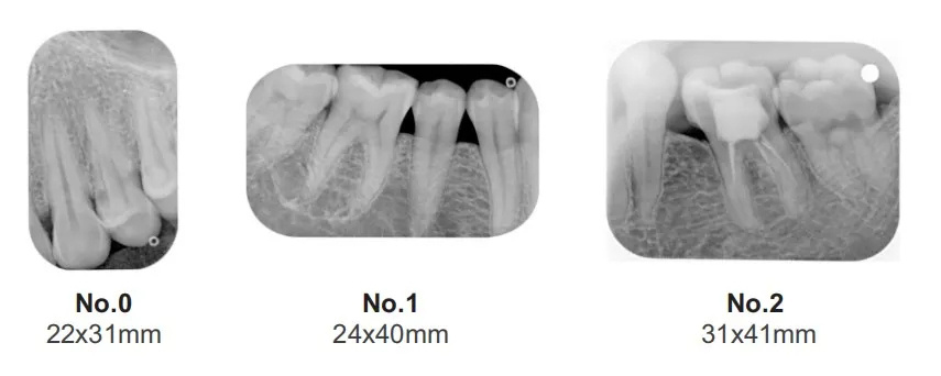 Dental X-Ray Film Reader Hardware Evaluation