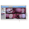 MD-2400P USB Dental Camera