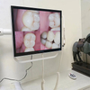 YFHD-D+ Intraoral Camera And Monitor Unit
