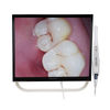 YFHD-D+ Intraoral Camera And Monitor Unit