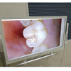 YF-2200P USB Dental Camera