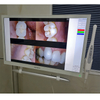 YF-2200P USB Dental Camera